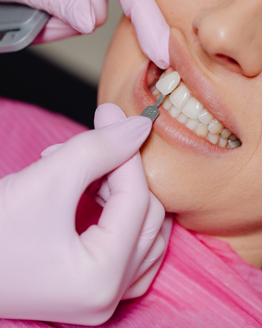 Estètica dental Barberà